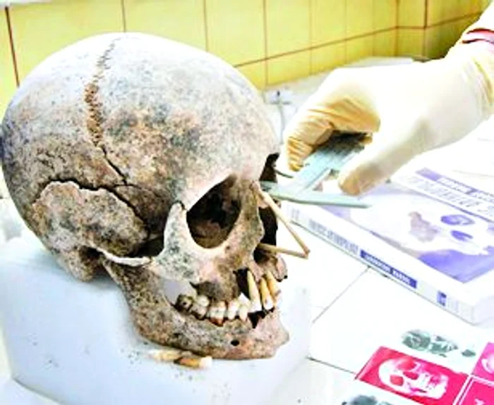 Pentru a se  afla cu exactitate  dacă victima a fost femeie sau  bărbat, criminalistul măsoară  şi dimensiunea ochiului