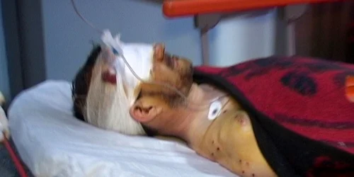 impuscat uzlina tulcea