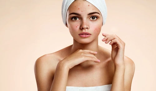 1 76779 original jpg jpeg