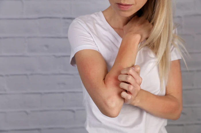 Suntem programați să evităm persoanele care se scarpină FOTO Shutterstock 