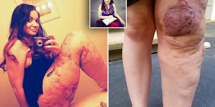 Suferă de o boală rară care i-a afectat unul dintre picioareFoto Twitter