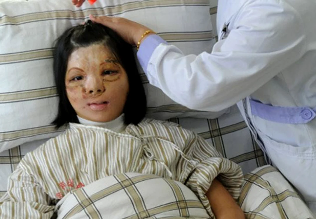 
    Xu Jianmei se bucură acum de un chip nou (foto Reuters)  