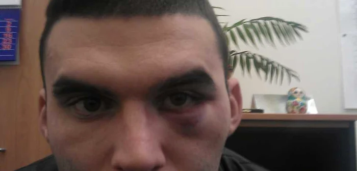 Băiatul a solicitat ceritificat medico-legal FOTO Claudia Untaru Creţu