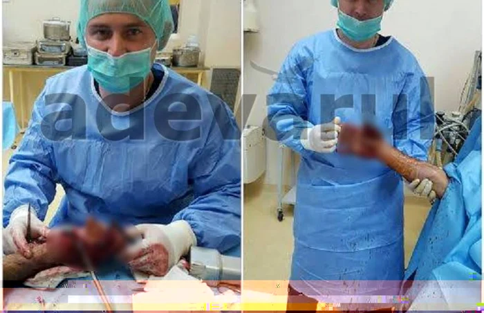 Chirurgul Oleg Tacu operează amputaţii de membre într-un spital uitat de lume FOTO Arhiva personală