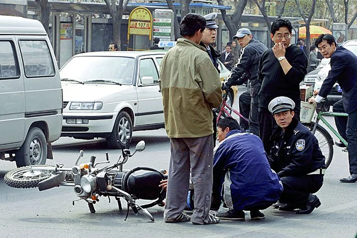 Zhang Pen, de 14 ani, se bărbiereşte  în fiecare zi din cauza unei dereglări hormonale