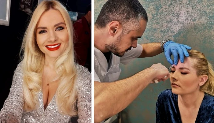 
    Ianna Novac și-a eliminat un rid cu ajutorul botoxului  