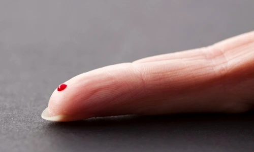 1 73177 original jpg jpeg