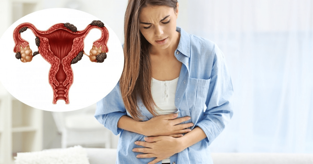 Cercetătorii testează primul nou medicament pentru endometrioză din ultimii 40 de ani
