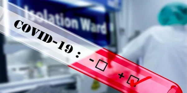 Termometru Covid-19 coronavirus Sursa news.ro