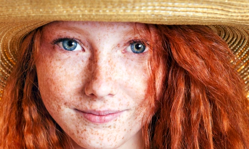 1 pistrui pete pigmentare jpg jpeg