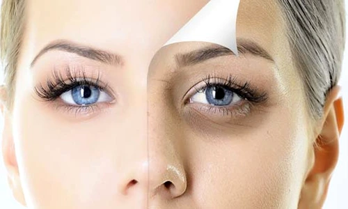 1 77959 original jpg jpeg