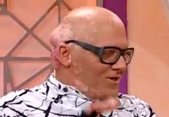 În toamnă, Marian Dârţă va fi supus unei noi intervenţii chirurgicale