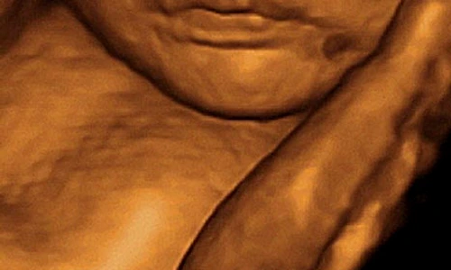 1 72204 original jpg jpeg