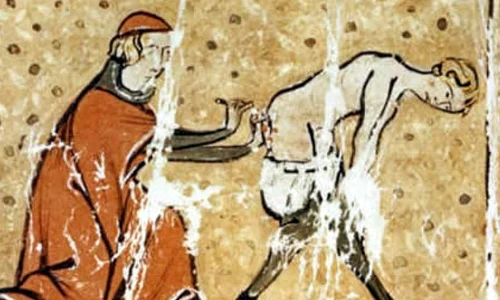 Zece tratamente medicale «diabolice» aplicate in Evul Mediu jpeg