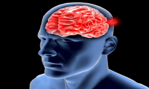 1 79434 original jpg jpeg