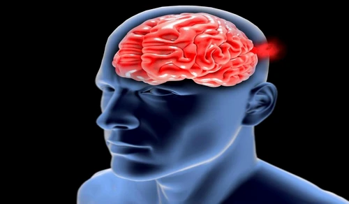 1 79434 original jpg jpeg