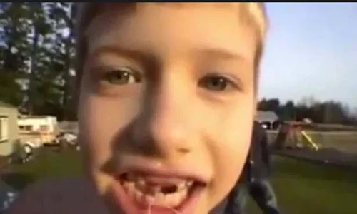 copilul nu a simtit nicio durere jpeg