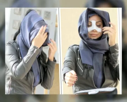 5 daniela crudu imagini cu fata tumefiata dupa ce a fost externata 1 jpg jpeg