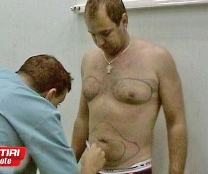 Iubitul Crinei Matei nu e singurul mascul din showbiz care s-a înfrumuseţat în cabinetul medicului estetician