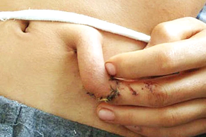 Xiao Wei, înainte de operaţie (Fotografii: Reuters)