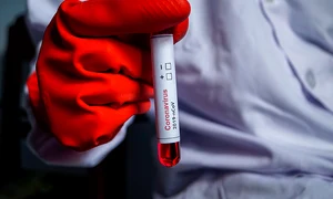 1 anticorpi virus sars cov 2 jpg jpeg