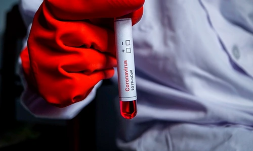 1 anticorpi virus sars cov 2 jpg jpeg