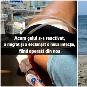  Avocată din Galați, avertisment după 30 de operații din cauza Aquafilling FOTO: Facebook/Daniela Dana