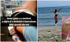  Avocată din Galați, avertisment după 30 de operații din cauza Aquafilling FOTO: Facebook/Daniela Dana