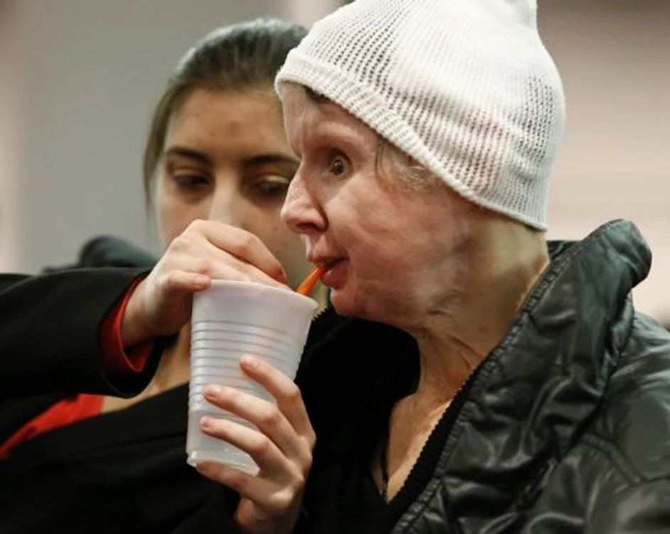 Charla Nash (FOTO REUTERS)