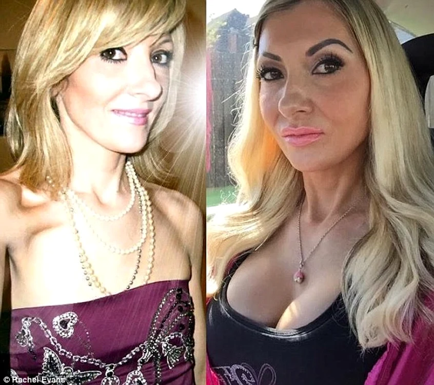 Rachel Evans a cheltuit peste 32.000 de lire sterline pentru a se apropia de aspectul de păpuşă Barbie pe care şi-l doreşte
