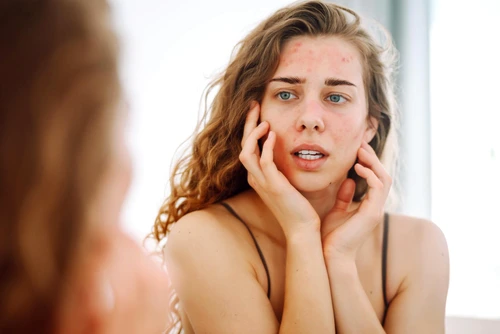 Greșeli frecvente în îngrijirea pielii care pot agrava problemele dermatologice