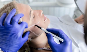 operatie estetica jpg