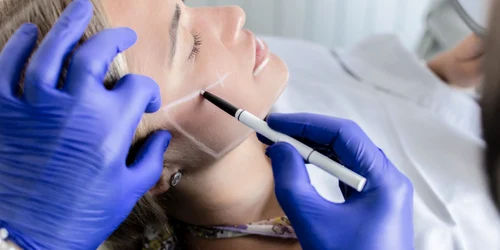 operatie estetica jpg