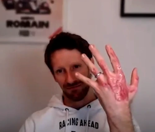 Cum arată mâna lui Romain Grosjean foto captura video