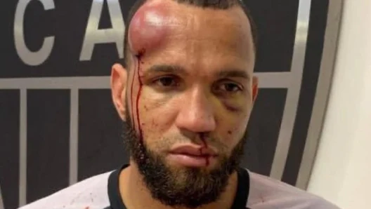 „Bătaia secolului” în Brazilia: fotbaliștii s-au lovit cu pumnii și picioarele. Meciul Cruzeiro-Atlético Mineiro a avut 23 de eliminați!