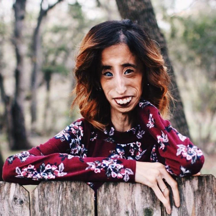 Lizzie Velasquez.