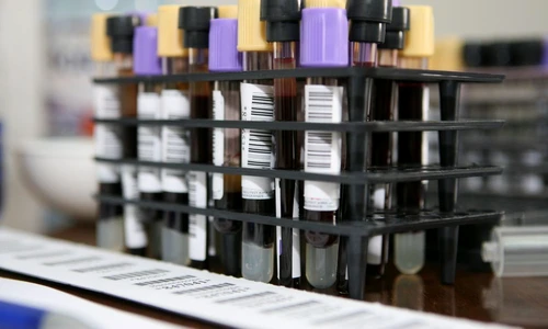 1 65656 original jpg jpeg