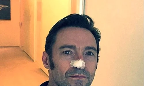 hugh jackman cancer jpeg