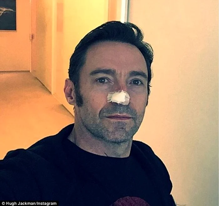 hugh jackman cancer jpeg