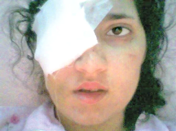 Tânăra de 23 de ani  şi-a pierdut ochiul drept