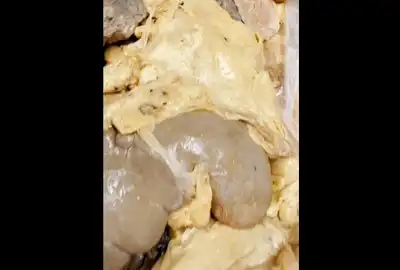 grasime 1 gif gif