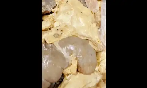 grasime 1 gif gif