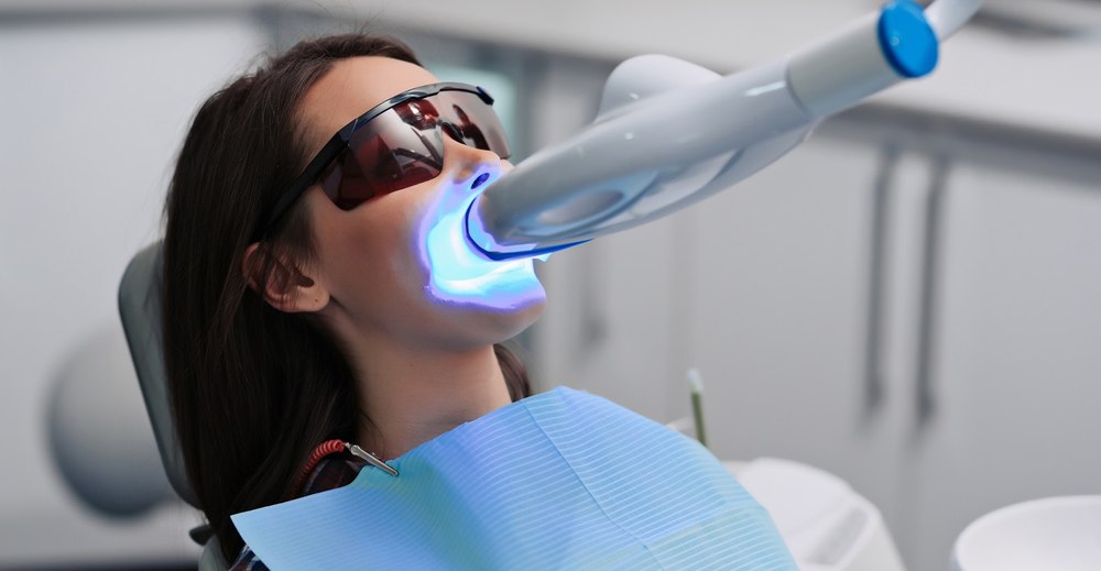 Estetica dentară și albirea dinților: Ghidul complet pentru un zâmbet perfect