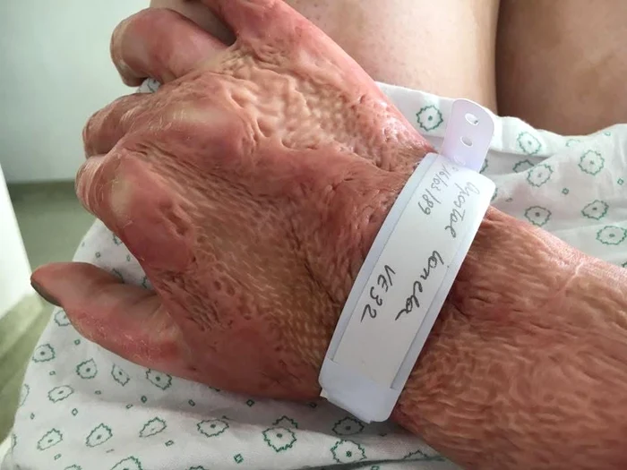 Mâna Adinei după incendiul din Colectiv