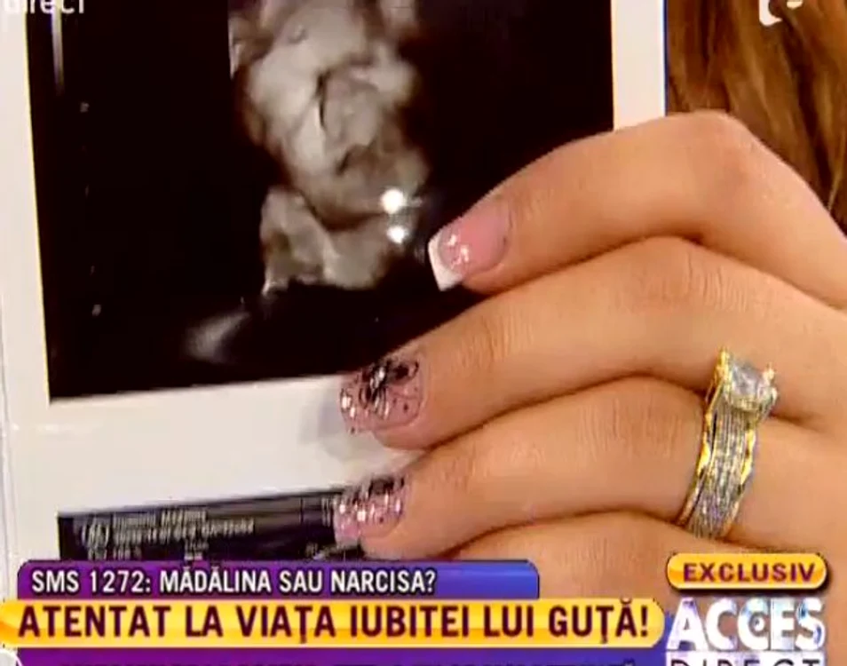 Ecografia lui Beyonce (FOTO ACCES DIRECT)