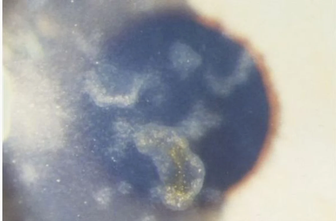 Bacteria începe să se dezvolte după aproximativ 20 de zile