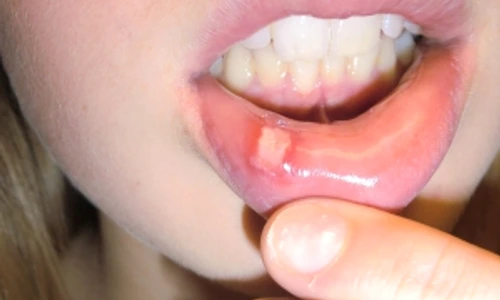 de ce apar aftele jpeg