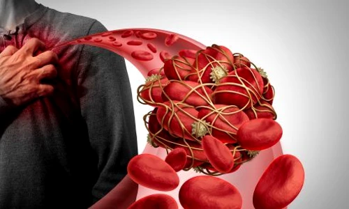 1 shutterstock 1483741823 jpg jpeg