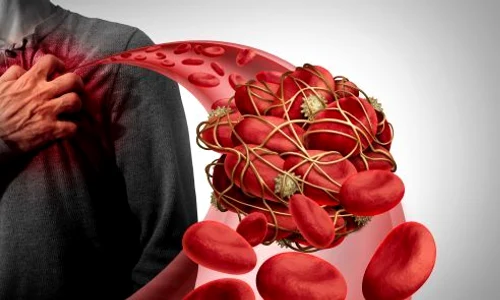 1 shutterstock 1483741823 jpg jpeg