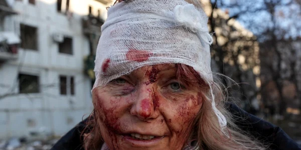 O femeie rănită fotografiată după atacul aerian de la Harkov Credit